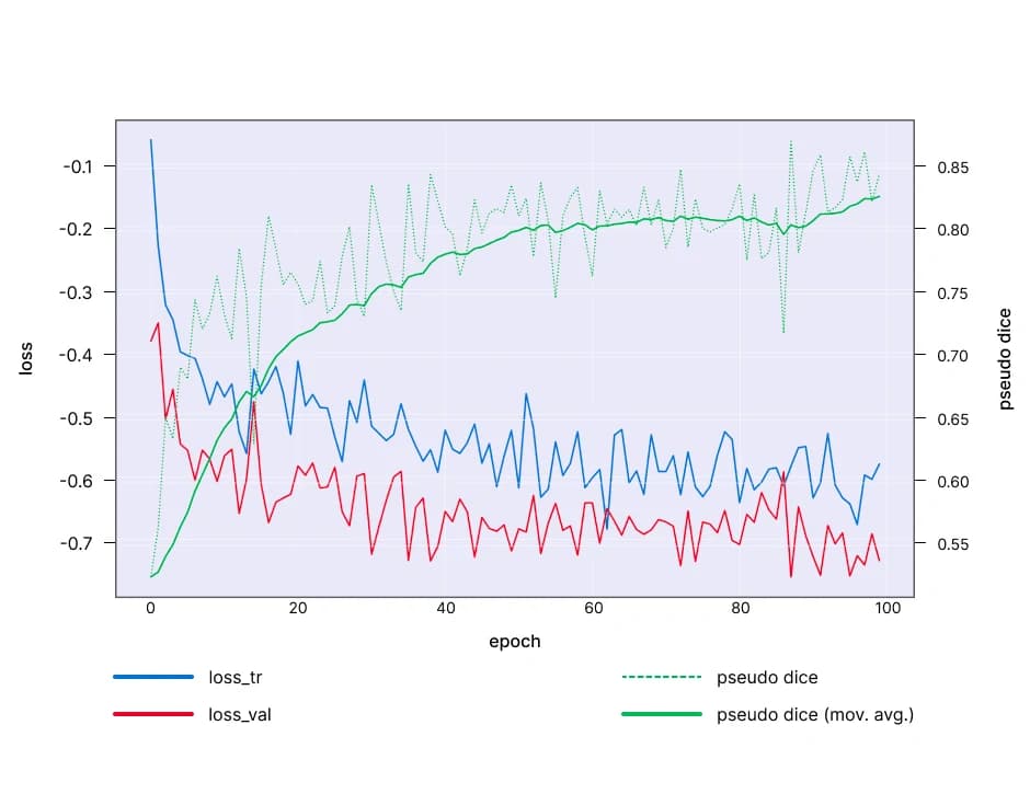 Training loss and validation chart for a clinical AI segmentation model